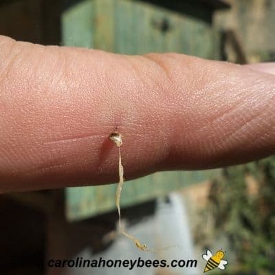 Honey bee stinger with venom sac attached in human finger image.