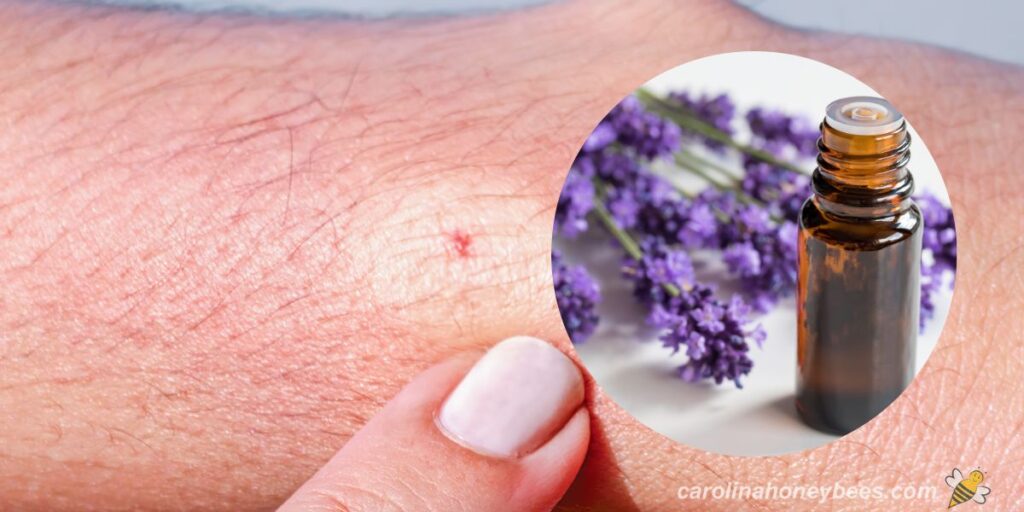 Using Essential Oils for Bee Stings Carolina Honeybees